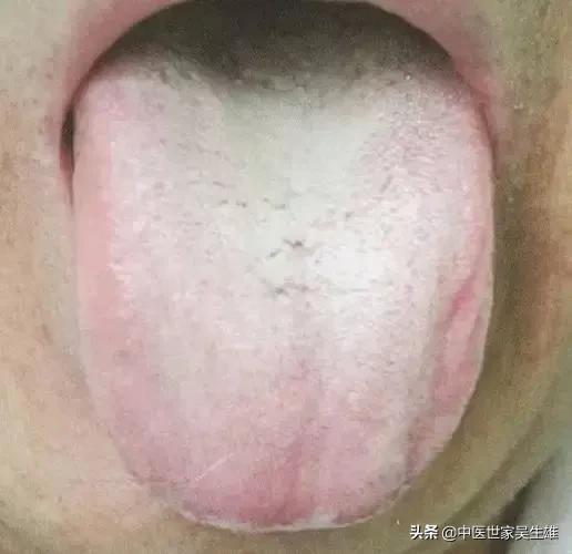 贴桂苓十香散湿贴会瘦吗（桂苓十香散湿贴）